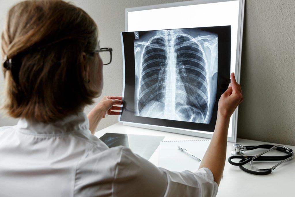 Doctor reviewing chest X-ray results during cheapest immigration medical exam Houston to assess lung and heart health requirements.